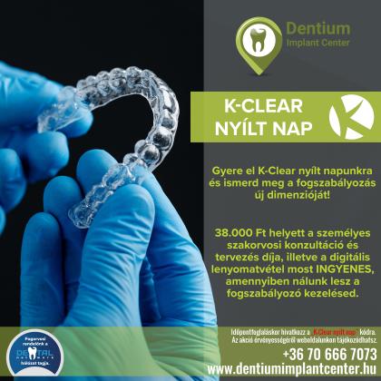 K-Clear nyílt nap