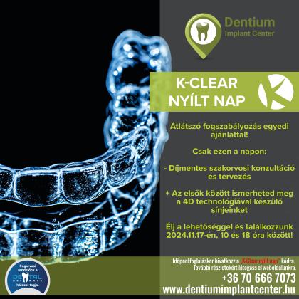 K-Clear nyílt nap