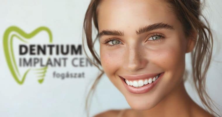 melyik a legjobb fog implantátum árak és minőség alapján Budapest